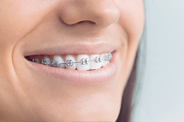 Best Invisalign and Clear Aligners  in Zebulon, NC